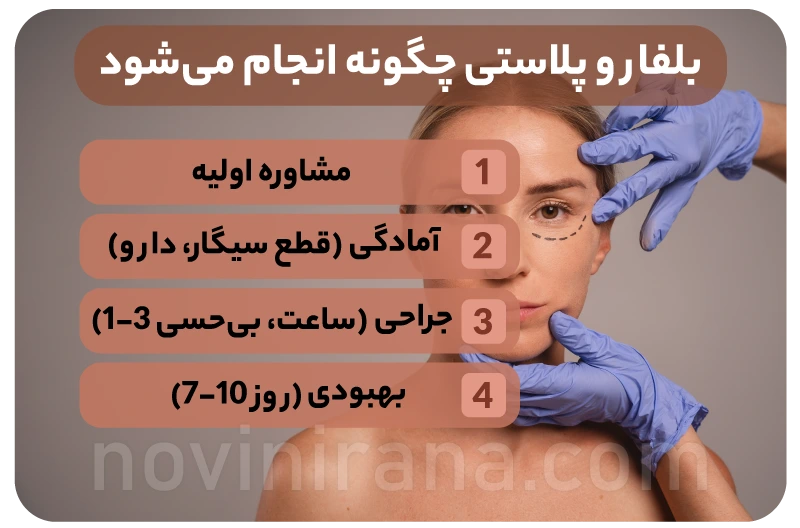 بلفاروپلاستی یا جراحی پلک چیست و چگونه انجام می شود؟
